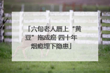 六旬老人唇上“黄豆”拖成癌 四十年烟瘾埋下隐患